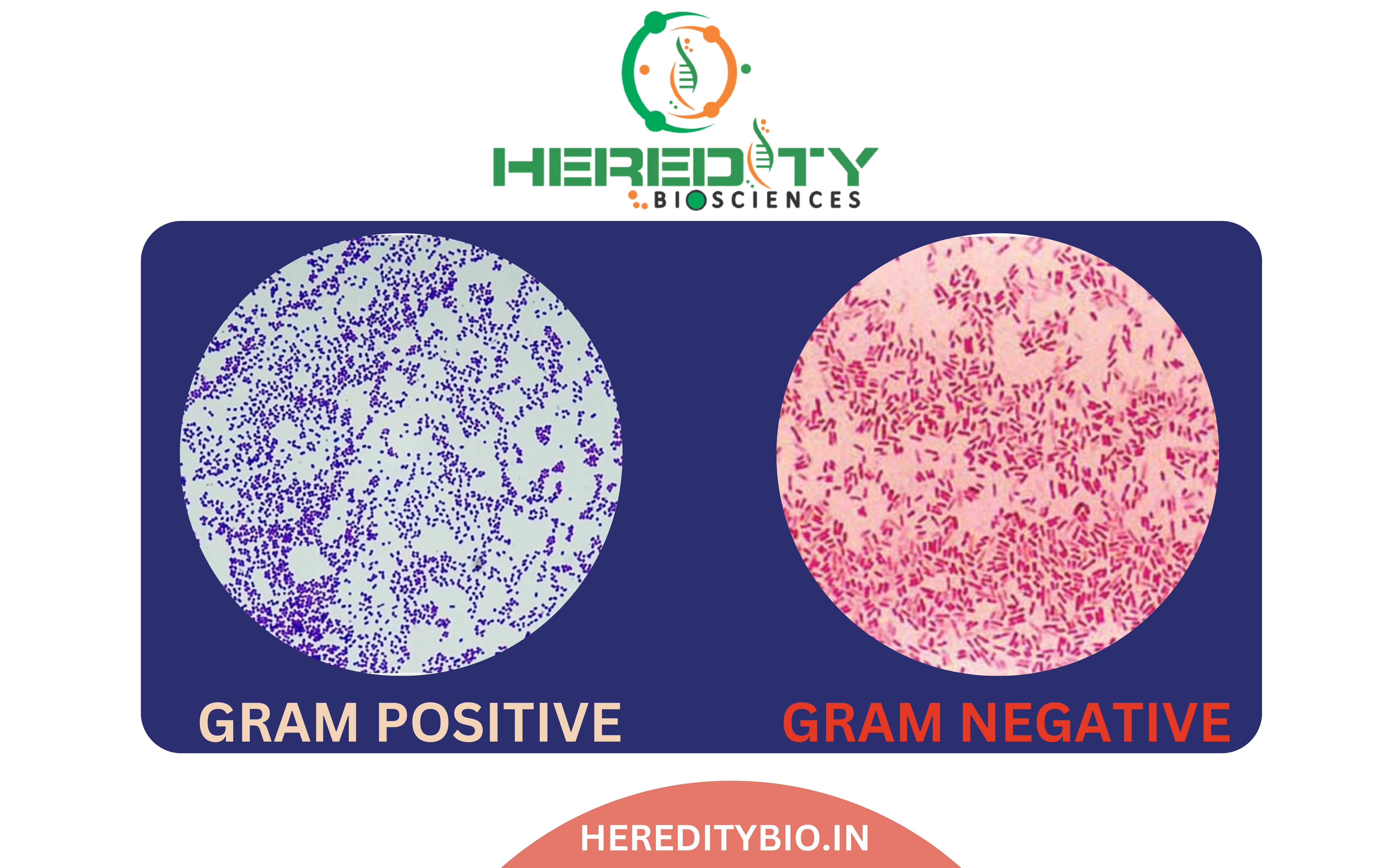 You are currently viewing What is difference between Gram-positive and Gram-negative bacteria?