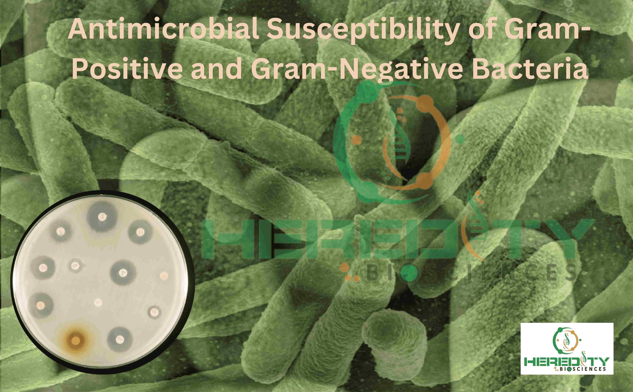 You are currently viewing Antimicrobial Susceptibility of Gram-Positive and Gram-Negative Bacteria